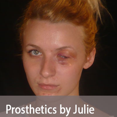 prostheticsno1