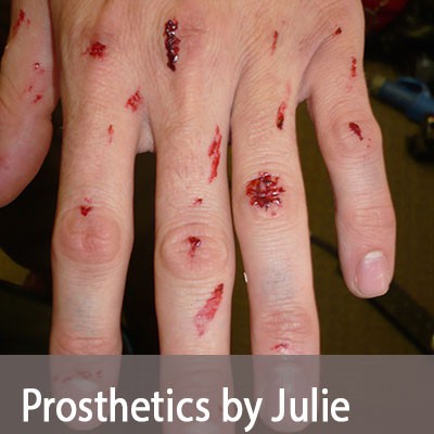 prostheticsno3
