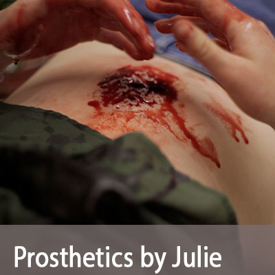 prostheticsno5
